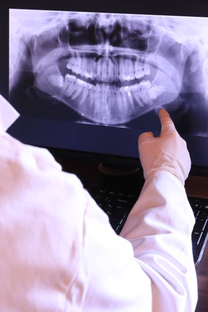 Best Knocked-Out Tooth Emergency  in Chinook, MT