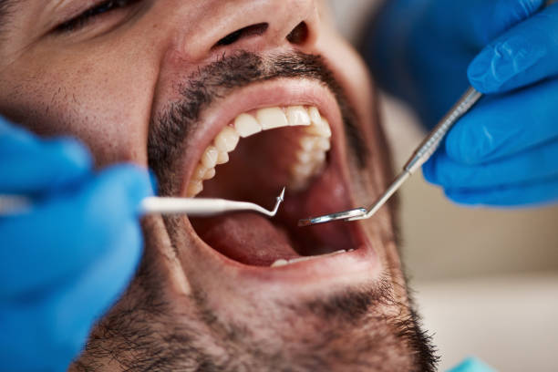 Urgent Tooth Repair in MT